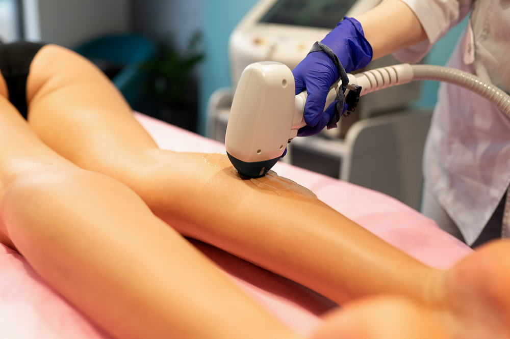 Svelando i segreti dell’epilazione laser a Palermo: la tua guida completa